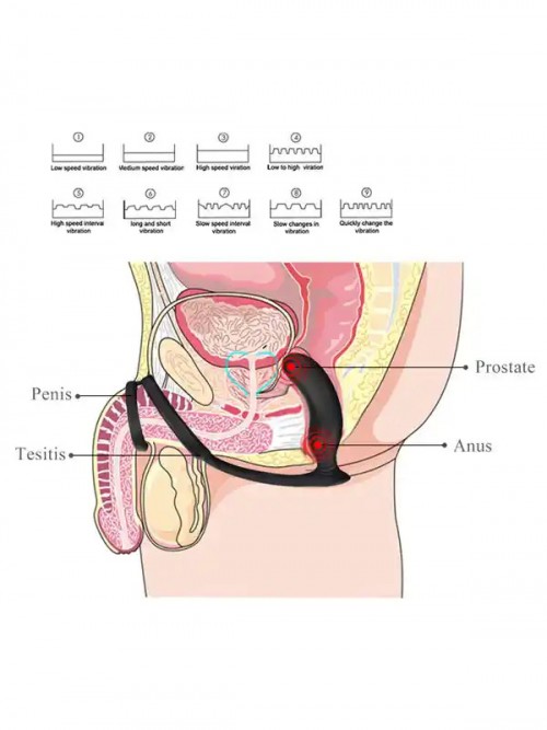 NOXXX Halo Prostat ve Penis Halkalı Şarjlı Anal Masaj Vibratörü Ek Resim