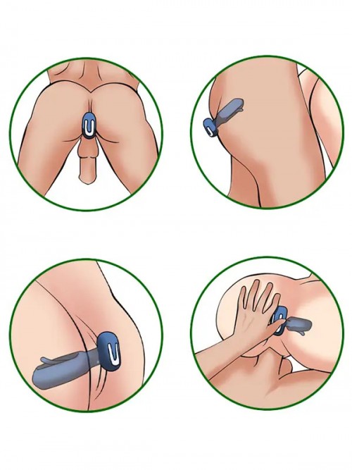 NOXXX A-Heros PAT PAT Şarjlı Titreşimli Dil Fonksiyonlu Anal Vibratör 3